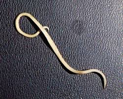 Roundworm | nematode species, Ascaris lumbricoides | Britannica