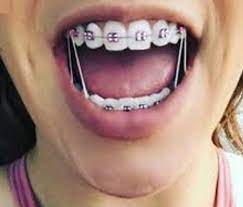 But remember, these braces are fake and should not be used in place of actual braces if you're in need of orthodontic care. How To Make Fake Braces With Rubber Bands Step By Step Howtogetbetterinlife Com