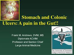 However, the good news is that instead of antibiotics and medication, we have many alternative treatments on how to treat a stomach ulcer. Stomach And Colonic Ulcers A Pain In The Gut Online Presentation