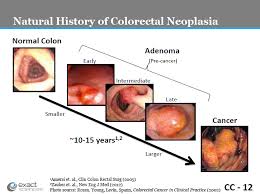 nca screening for colorectal cancer