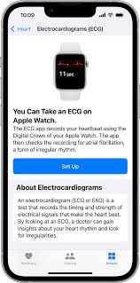 an ecg with the ecg app on apple watch