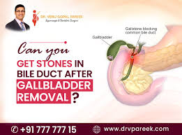 bile duct after gallbladder removal