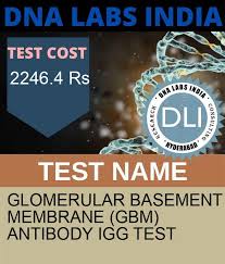 Gbm Anti Igg Test