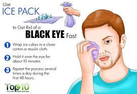 can lip balm help heal a black eye