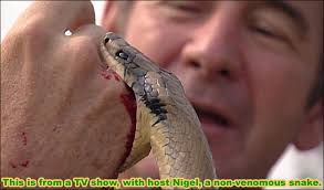 bitten by a snake bite advice