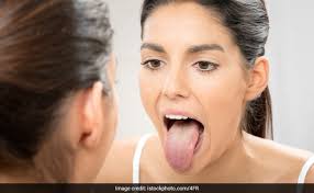 dark spots on your tongue