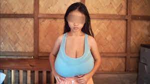 12-year-old girl in Palawan suffers from overgrown breasts that weigh  nearly 20kg | GMA News Online