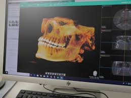 3d dental imaging general dentistry