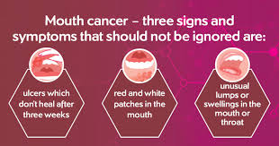 mouth and throat cancers