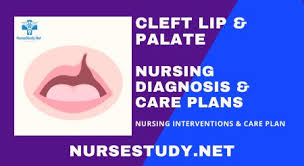 cleft lip and palate nursing diagnosis