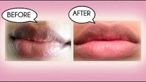 how to lighten dark lips naturally