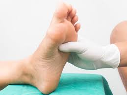 Image result for Gout treatment