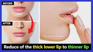 reduce of the thick lower lip fat lip