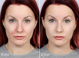 face redness relief powder