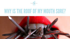 Metal roofing is pricey but resilient. Why Is The Roof Of My Mouth Sore Glen Dental