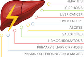 Fatty Liver Diet Guide