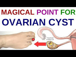 Acupressure Points For Pcos Acupressure Points For Ovary