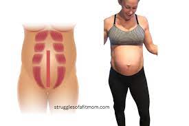strong abs during pregnancy