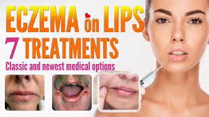 lip eczema around mouth dermais