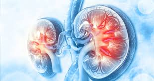 Disease of the kidney can be generally classified as acute or chronic. Patients With Both Gout Chronic Kidney Disease Undertreated
