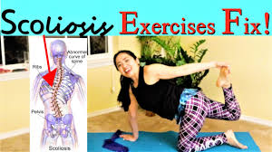 scoliosis exercises follow along