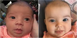 Baby Eye Color Then Now Babycenter