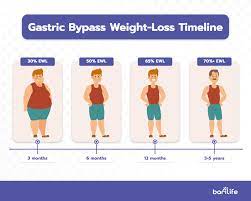 gastric byp weight loss chart