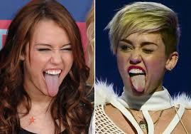 Miley Cyrus Tongue Diagnosis By An Irvine Acupuncturist