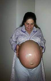 Post [176152189626] - pregnantextreme.tumblr.com - Tumbex