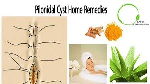 home remes for pilonidal sinus dr