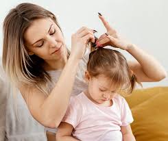 how to get rid of pesky head lice