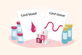 umbilical cord blood and tissue stem