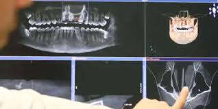 cone beam technology koppelman dental
