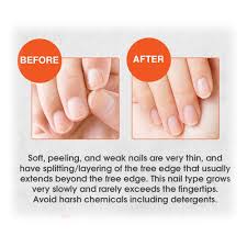 nail tek intensive therapy 2 for soft