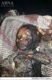 Image result for war crimes in Yemen