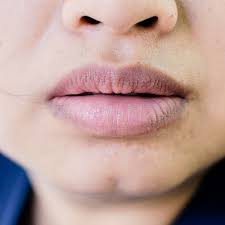 dark lips treatment cost in abad