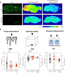 However, the price is reasonable when you consider the high quality of the hardware and the overall. Regulation Of Anxiety And Depression By Mitochondrial Translocator Protein Mediated Steroidogenesis The Role Of Neurons Springerlink