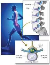 prolotherapy for disc disease cause