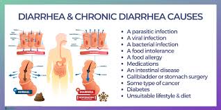 diarrhea symptoms causes treatment