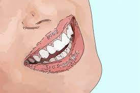 upper teeth numbness can be seen a few