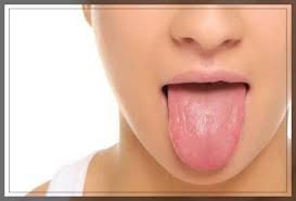 tingling tongue 9 possible causes and