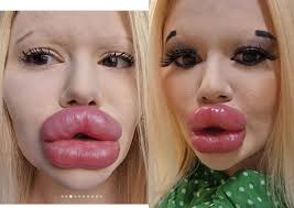 paid r400k to get world s biggest lips