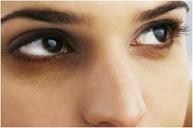 under eye dark circles cure 5 natural