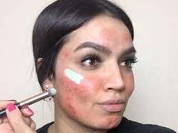 makeup tutorial for covering up acne