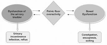 overactivity of pelvic floor muscles