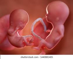 Twins Fetus Images, Stock Photos & Vectors | Shutterstock