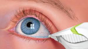 3 common eye infections their