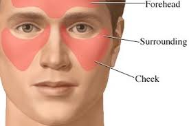 treat sinus headache through ayurveda