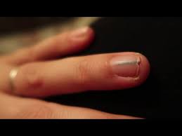 giant splinter from under my fingernail