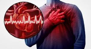 But heart attacks can create problems. Heart Attack And Sudden Cardiac Arrest Know The Difference